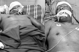 मोरङमा ट्याक्टर चालकले लाट्ठीले हान्दा ट्रक चालक गम्भीर घाइते